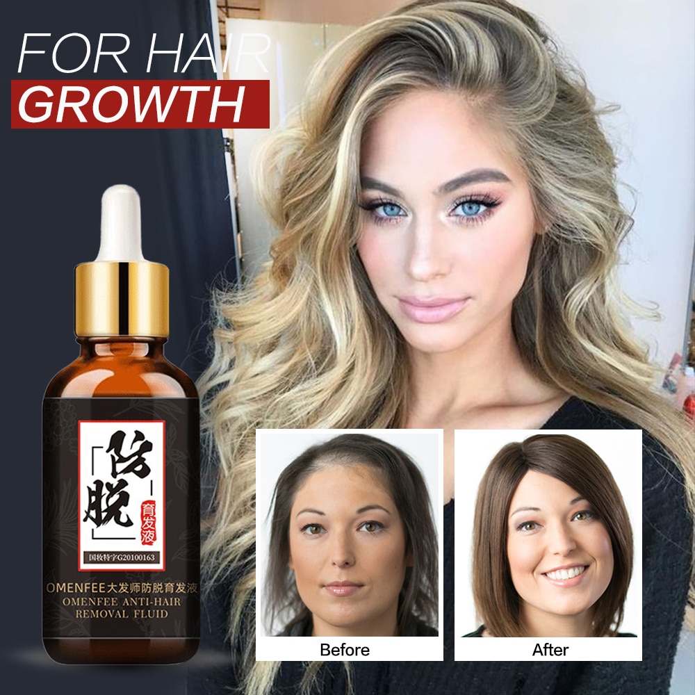 Hair Care Hair Growth Essential Oils Essence Grow Hair Liquid Fluid Prevent Hair Loss Health Care Beauty Dense Hair Growth Serum