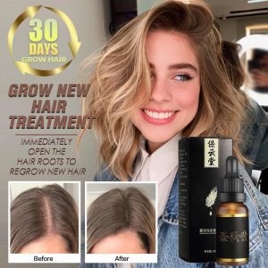 Hair Growth Essential Oil Anti Hair Loss Essence Repair Damage Hair Growth Treatment Thick Root Repair Dry Hair Care Products
