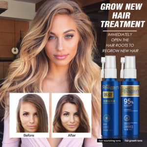 Hair Growth Essence Oil Spray for Hair Regrowth Oil Anti Hair Loss Hair Growth Serum liquid Hair Loss Treatment Hair Tonic